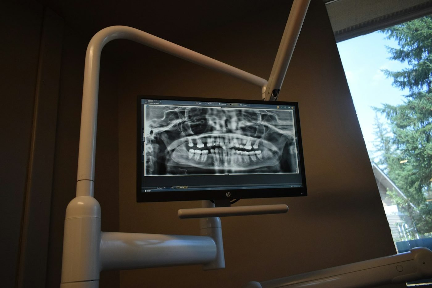 Digitales Röntgenbild auf einem Monitor